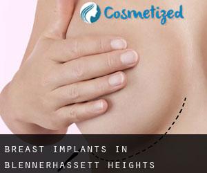 Breast Implants in Blennerhassett Heights