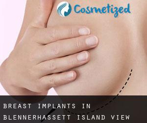 Breast Implants in Blennerhassett Island View Addition