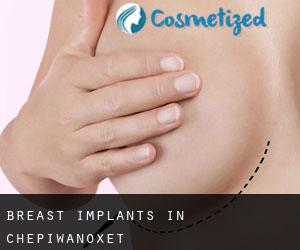 Breast Implants in Chepiwanoxet
