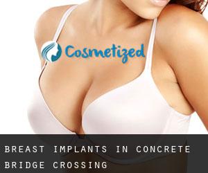 Breast Implants in Concrete Bridge Crossing