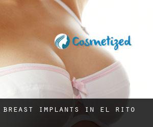 Breast Implants in El Rito