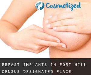 Breast Implants in Fort Hill Census Designated Place