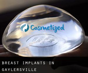 Breast Implants in Gaylersville