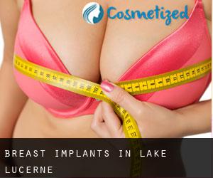 Breast Implants in Lake Lucerne