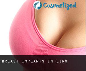 Breast Implants in Liro