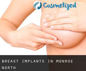 Breast Implants in Monroe North
