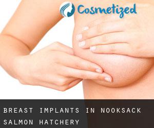 Breast Implants in Nooksack Salmon Hatchery