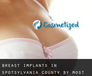 Breast Implants in Spotsylvania County by most populated area - page 1