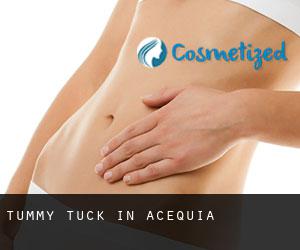 Tummy Tuck in Acequia