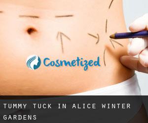 Tummy Tuck in Alice Winter Gardens