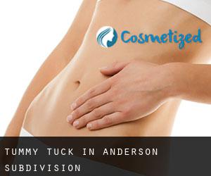 Tummy Tuck in Anderson Subdivision