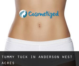 Tummy Tuck in Anderson West Acres