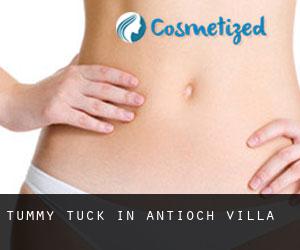 Tummy Tuck in Antioch Villa