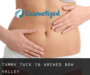 Tummy Tuck in Arched Bow Valley