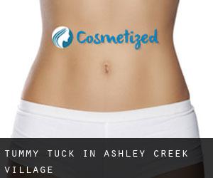 Tummy Tuck in Ashley Creek Village