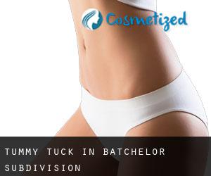 Tummy Tuck in Batchelor Subdivision