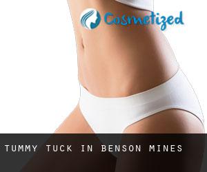 Tummy Tuck in Benson Mines