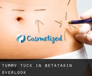Tummy Tuck in Betatakin Overlook