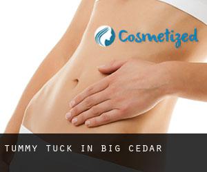 Tummy Tuck in Big Cedar