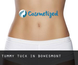 Tummy Tuck in Bowesmont