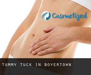 Tummy Tuck in Boyertown