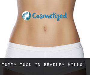 Tummy Tuck in Bradley Hills