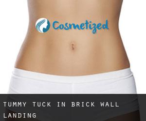 Tummy Tuck in Brick Wall Landing