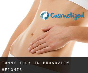 Tummy Tuck in Broadview Heights