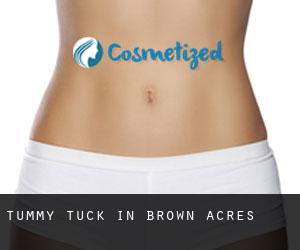 Tummy Tuck in Brown Acres