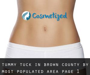 Tummy Tuck in Brown County by most populated area - page 1