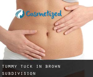 Tummy Tuck in Brown Subdivision