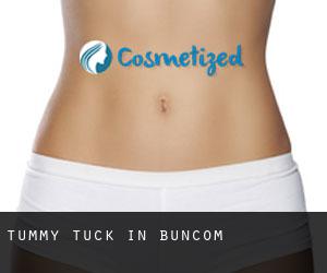 Tummy Tuck in Buncom