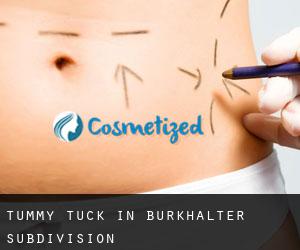 Tummy Tuck in Burkhalter Subdivision