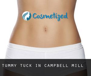 Tummy Tuck in Campbell Mill