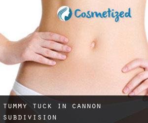 Tummy Tuck in Cannon Subdivision