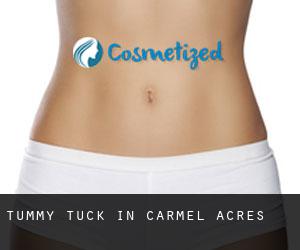 Tummy Tuck in Carmel Acres