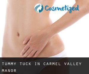 Tummy Tuck in Carmel Valley Manor