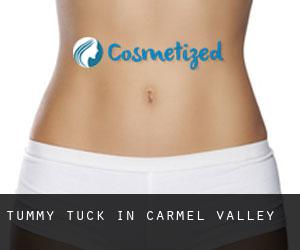 Tummy Tuck in Carmel Valley