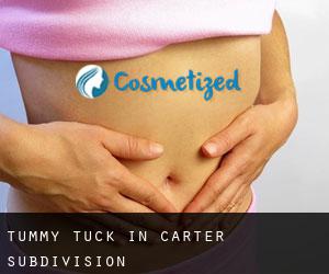 Tummy Tuck in Carter Subdivision
