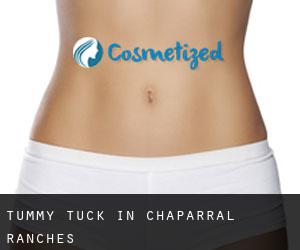 Tummy Tuck in Chaparral Ranches