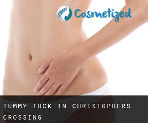 Tummy Tuck in Christophers Crossing
