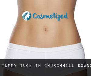 Tummy Tuck in Churchhill Downs