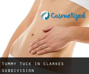 Tummy Tuck in Clarke's Subdivision