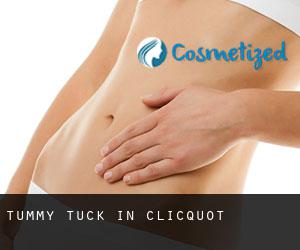 Tummy Tuck in Clicquot