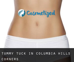 Tummy Tuck in Columbia Hills Corners