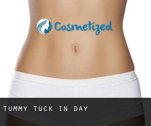 Tummy Tuck in Day