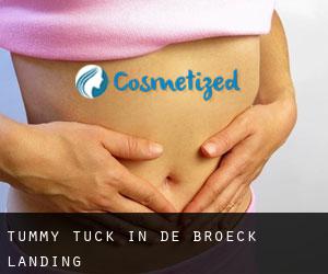 Tummy Tuck in De Broeck Landing