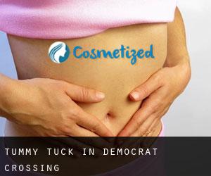 Tummy Tuck in Democrat Crossing