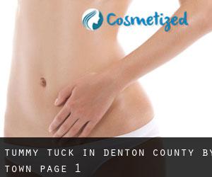 Tummy Tuck in Denton County by town - page 1