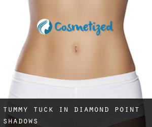 Tummy Tuck in Diamond Point Shadows